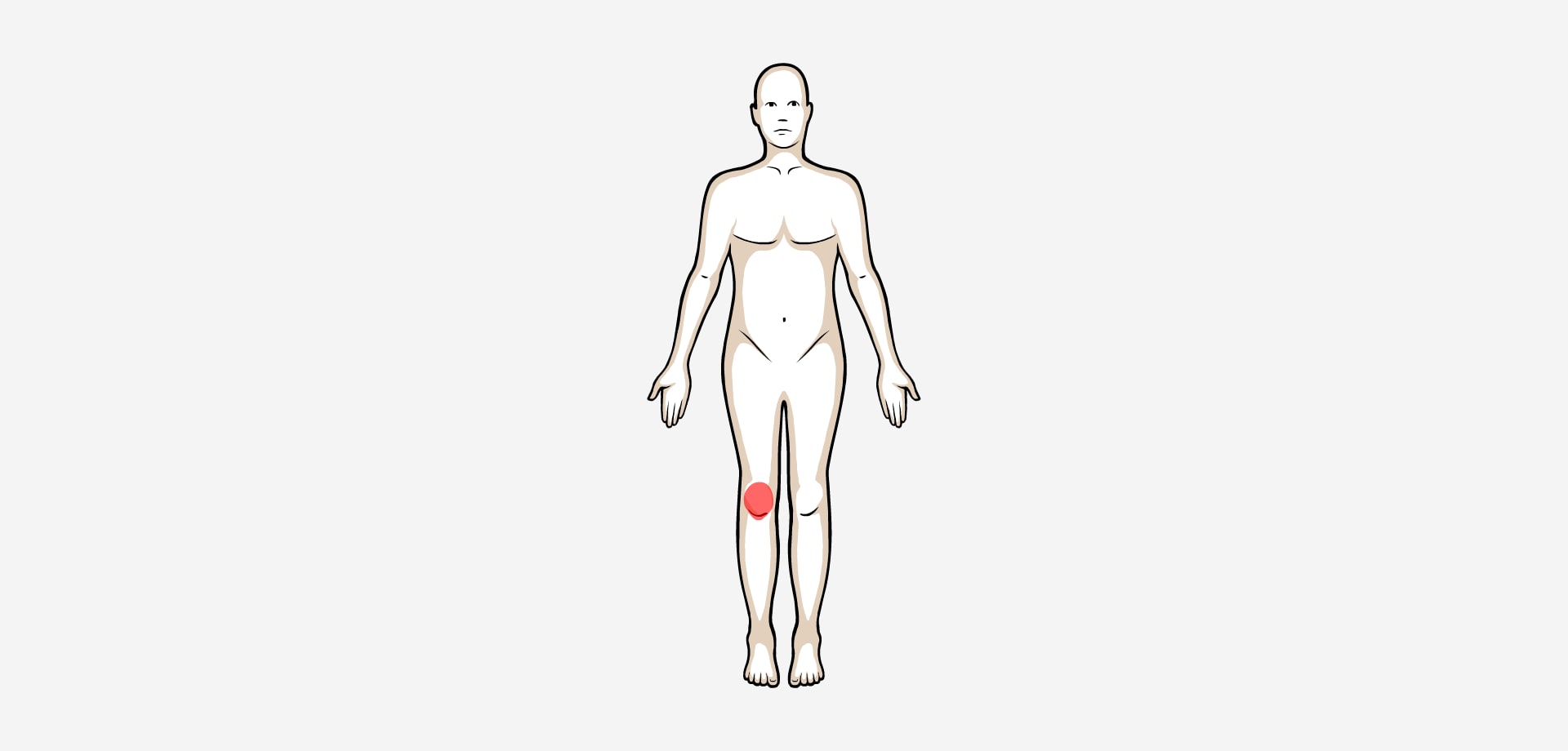 Dolor anterior rodilla
